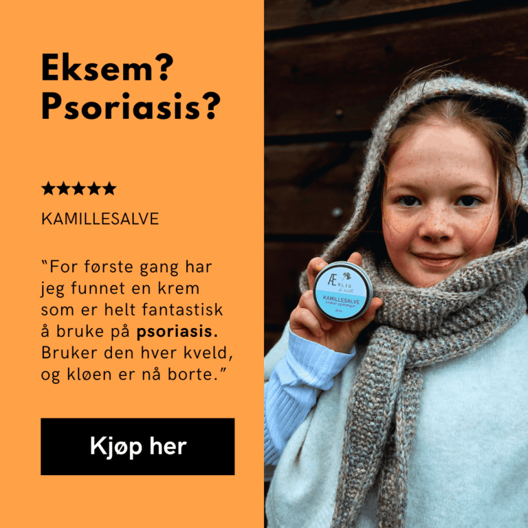 foto jente holder kamillesalve fra ærlig by walle